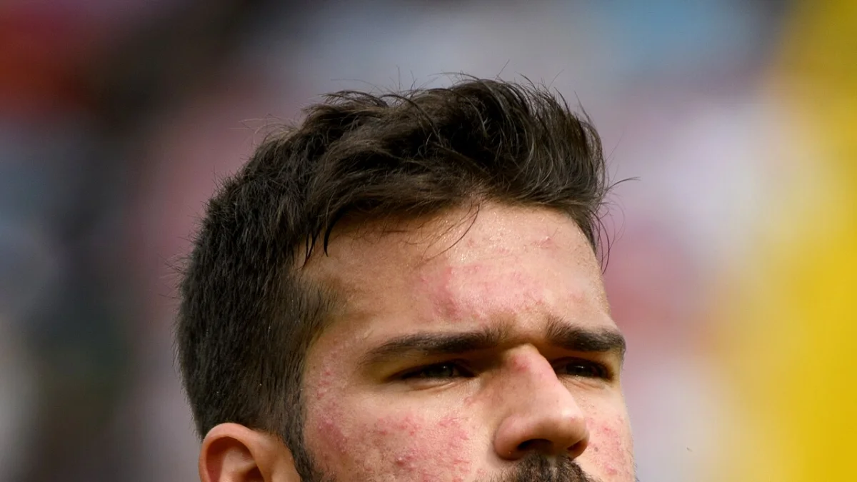 Alisson Becker — фото: Wikipedia